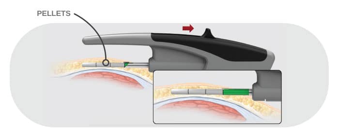 image of pellet delivery device by The Re3 Advanced Pellet Delivery System