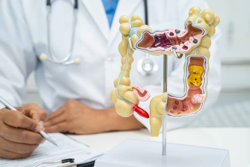 Image of digestive system model and doctor behind filling out a form.